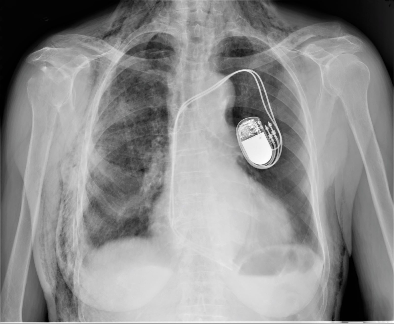 medical machining specialists